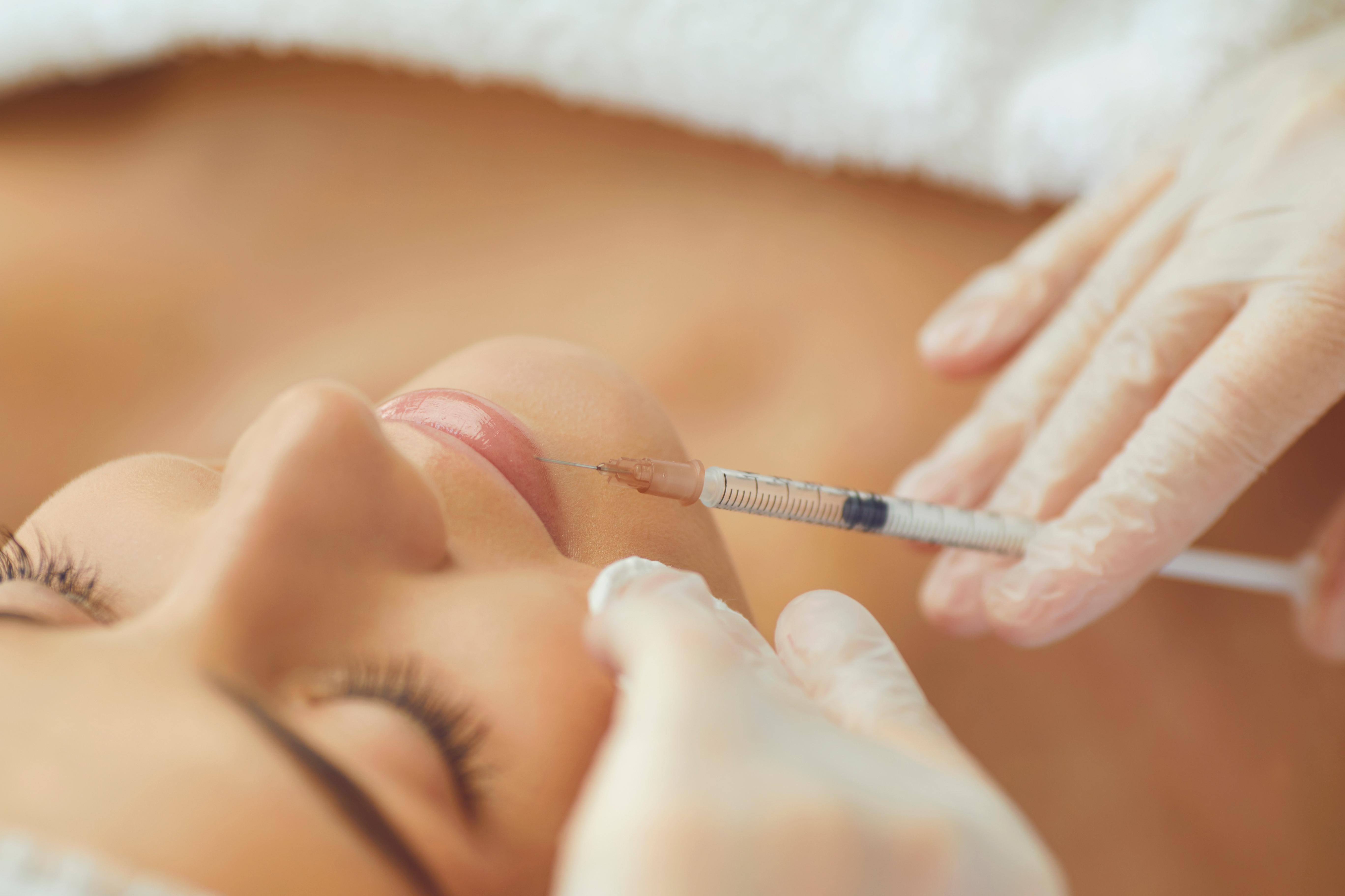 ボトックスとは